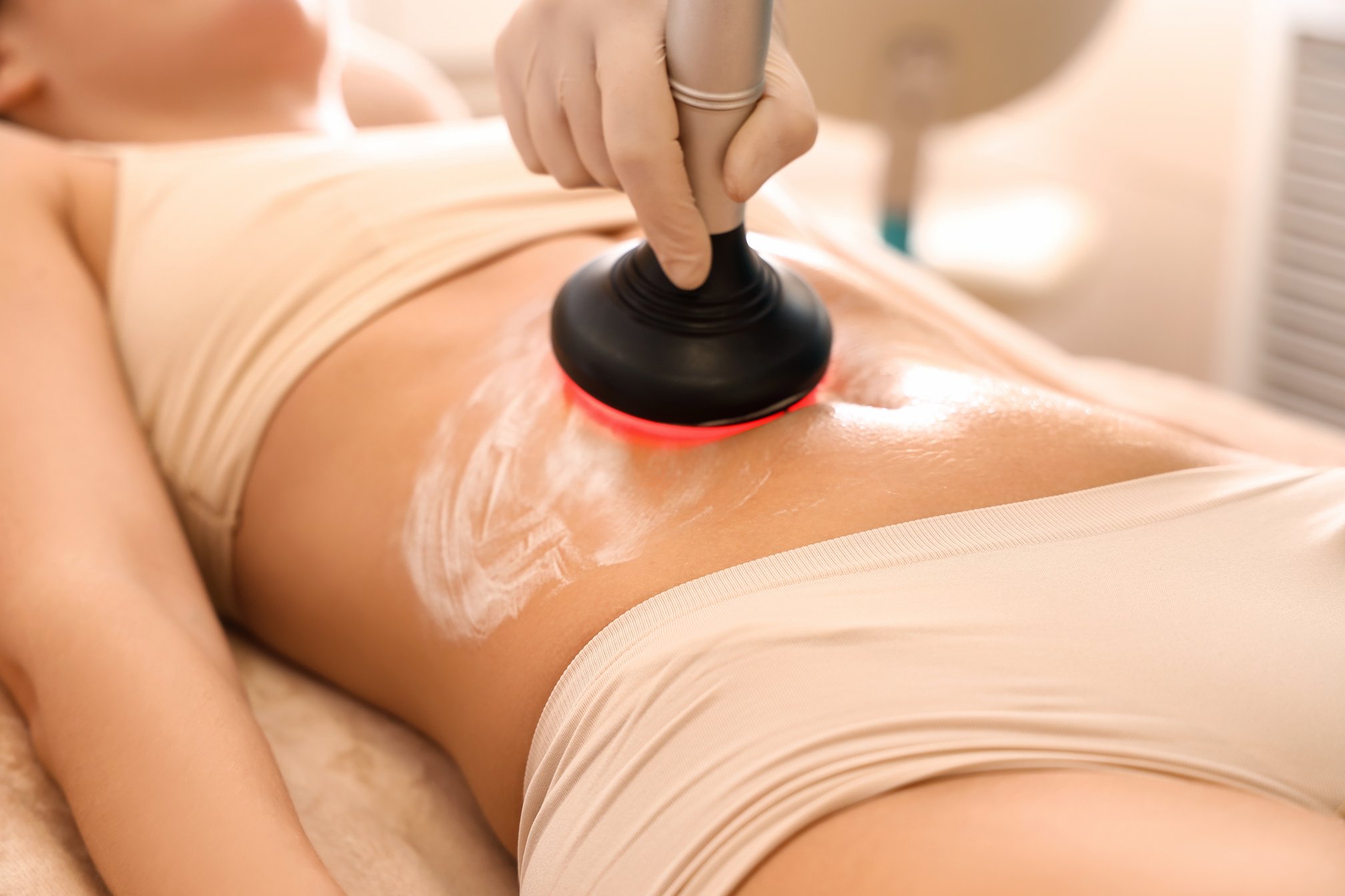 Young Woman Undergoing anti-Cellulite Treatment in Beauty Salon